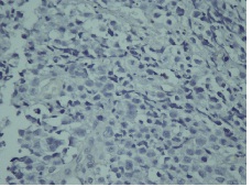 Fig 1F